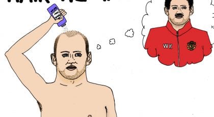Преди и след присаждане на коса какво да правя