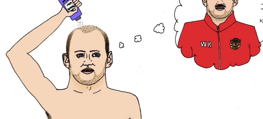 Преди и след присаждане на коса какво да правя